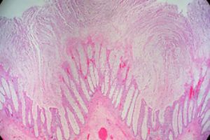 The next generation of Antibiotics could be Bacteriophages