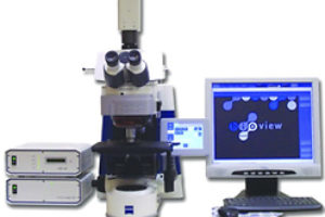 A new method for early diagnosis of lung cancer