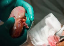 Progressive methods of organ transplantation