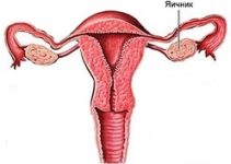 Preventive removal of the ovaries – the experts ‘ opinion Preventive removal of the ovaries – the experts ‘ opinion