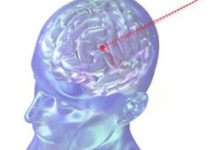 Radiation therapy has become safer Radiation therapy has become safer