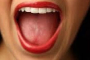 Hadassah and Harvard Collaborate on Link Between Mouth Bacteria and Colon Cancer