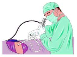 An improved method of thoracoscopy