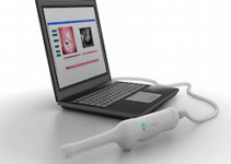 Early and Accurate detection of Cervical Cancer Early and Accurate detection of Cervical Cancer