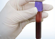 Hematology Hematology