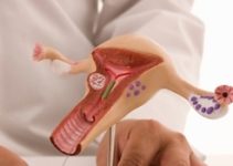 Gynecology Gynecology