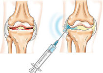 Rheumatology Rheumatology