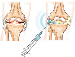 Rheumatology