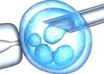 IVF (in vitro fertilization) IVF (in vitro fertilization)