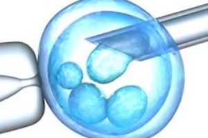 IVF (in vitro fertilization)