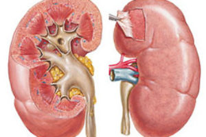 Nephrology