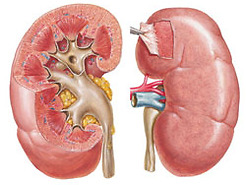 Nephrology