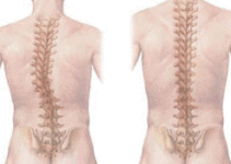 Orthopaedics Orthopaedics